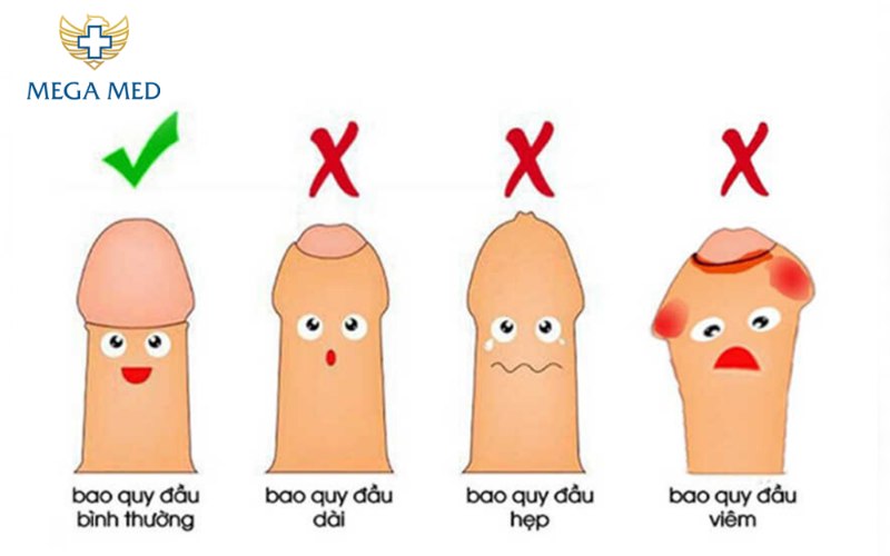 chia sẻ kinh nghiệm trước và sau khi cắt bao quy đầu